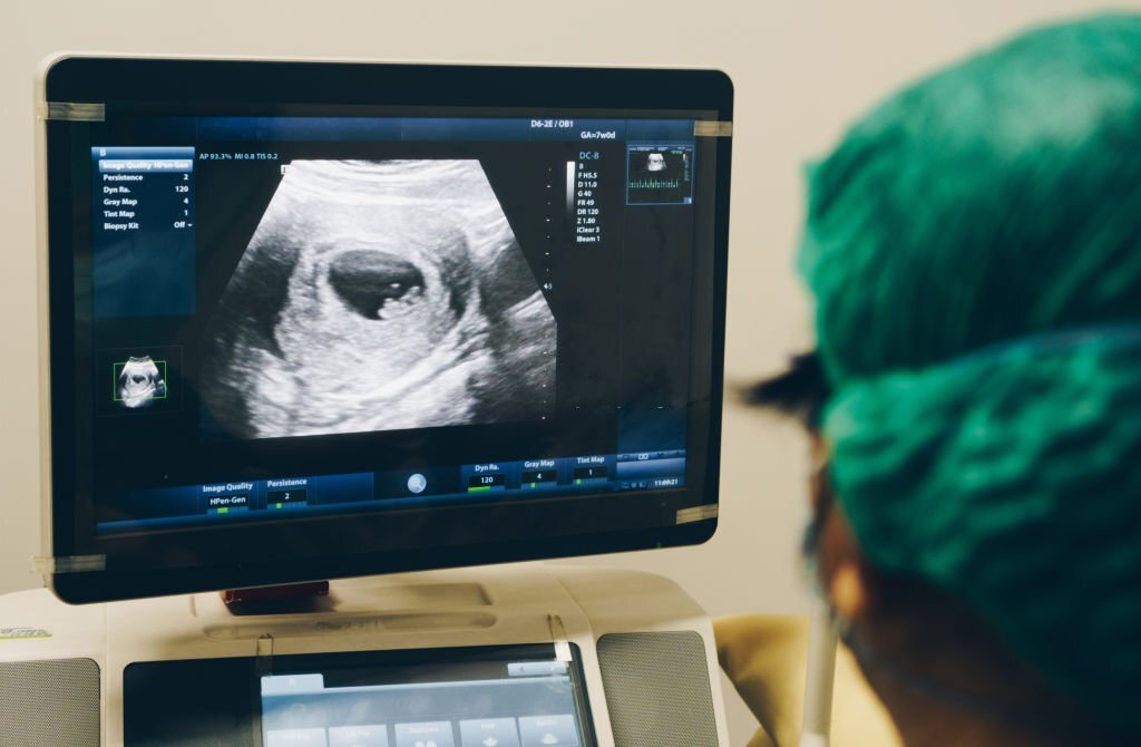Tüp Bebekte Ultrasonografi Nasıl Olmalıdır?